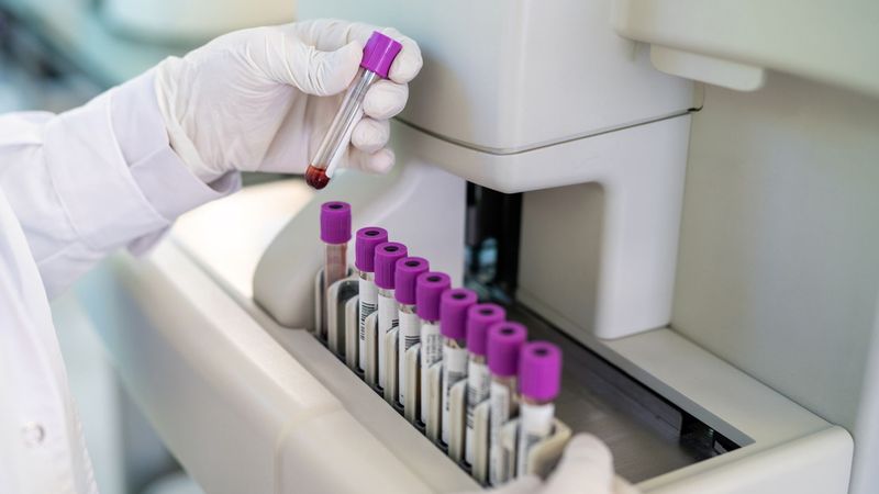imported-skynews-blood-test-study_7112781.jpg
