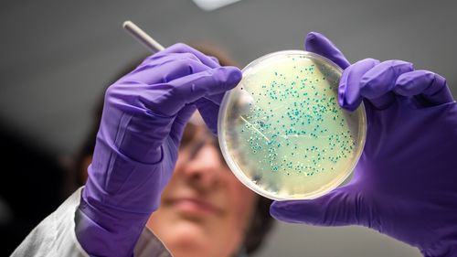 imported-skynews-salmonella-cancer_6751397.jpg
