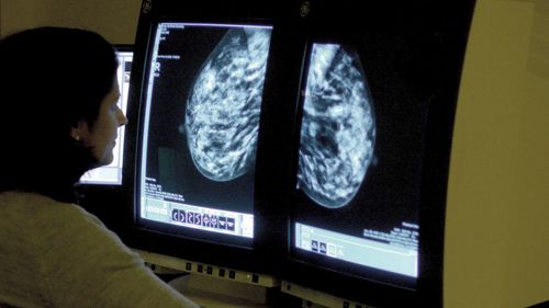 imported-skynews-breast-cancer-cancer_7313394.jpg