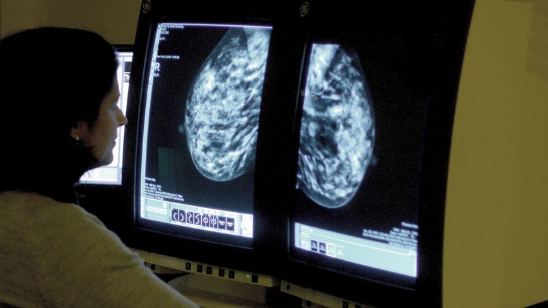 imported-skynews-breast-cancer-cancer_7313394.jpg