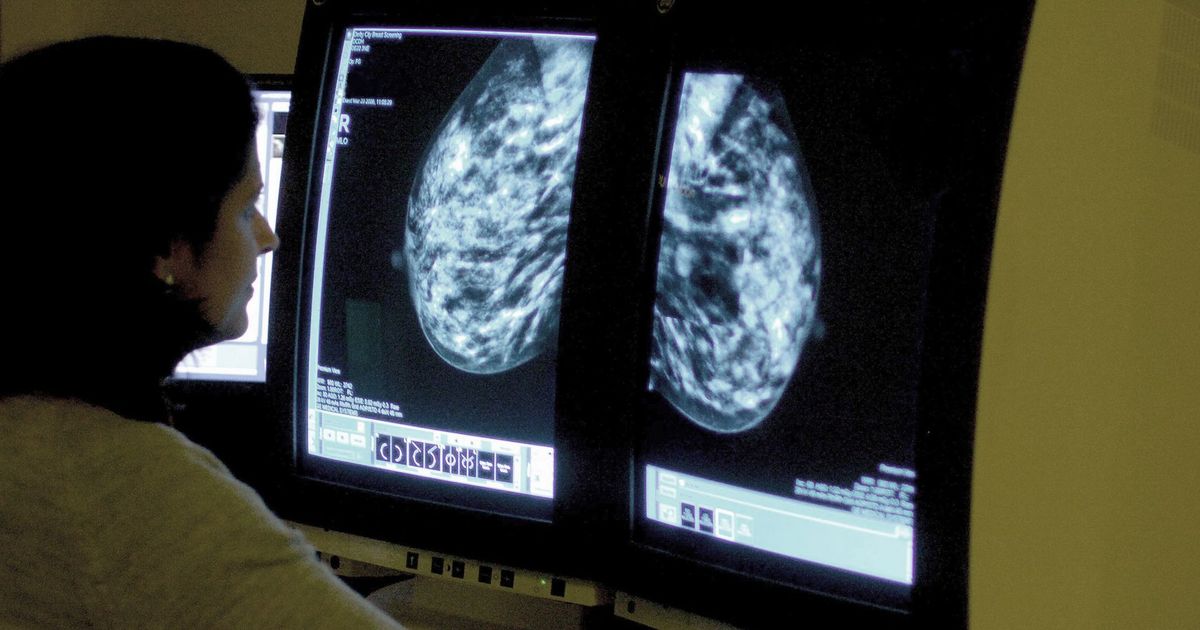 imported-skynews-breast-cancer-cancer_7313394.jpg