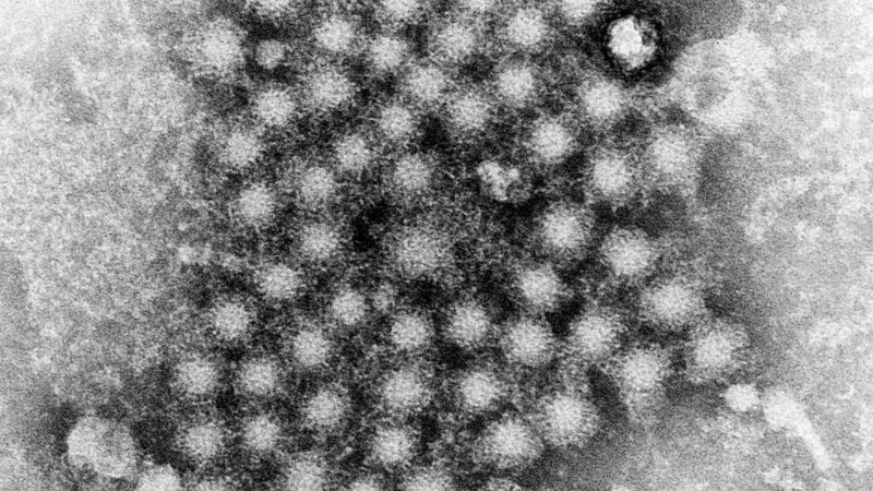 imported-skynews-hepatitis-illness-liver_5731264.jpg