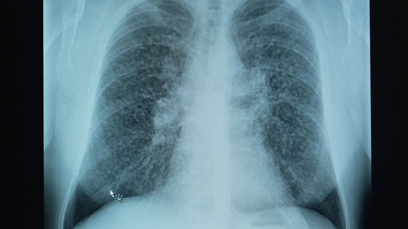 imported-skynews-silicosis-kitchens_7244384.jpg
