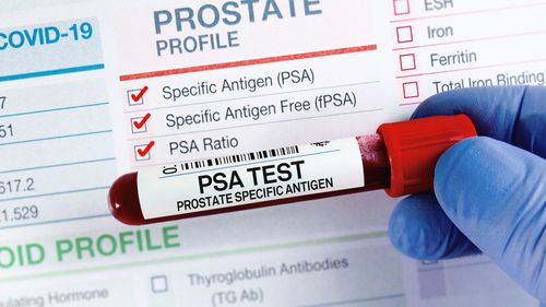 imported-skynews-blood-tube-test-psa_7002550.jpg