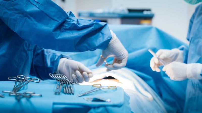 imported-skynews-operation-surgery_7315010.jpg