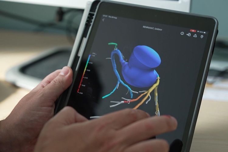 imported-nhsengland3dscan-80e82b.jpg