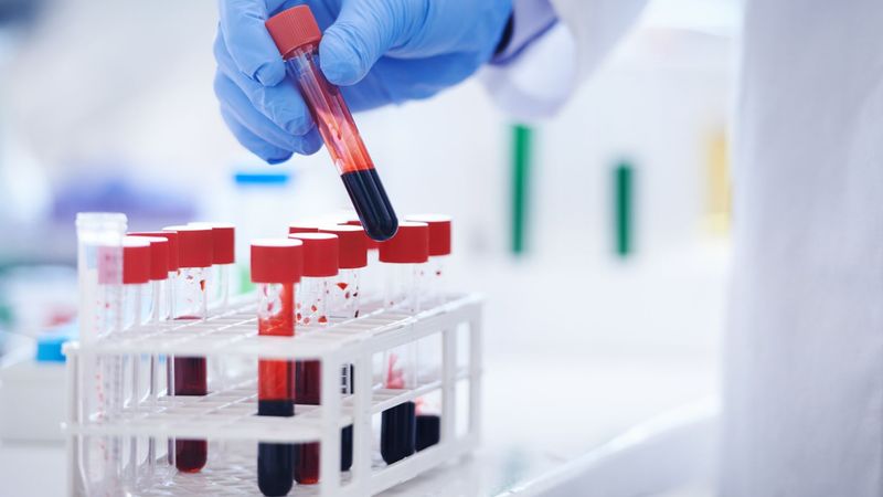 imported-skynews-blood-test-generic_6681990.jpg