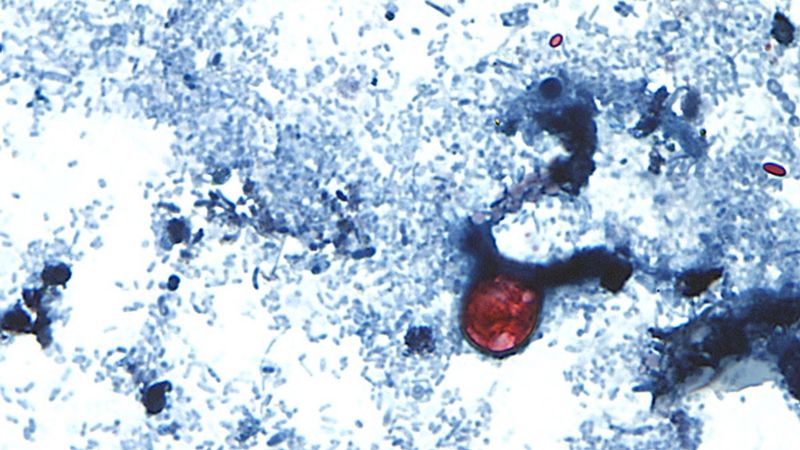 imported-skynews-cyclospora-virus_7313138.jpg