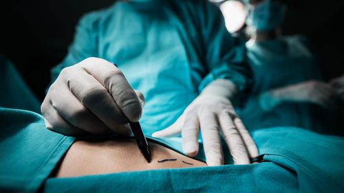 imported-skynews-cosmetic-surgery-butt-lift_6749254.jpg